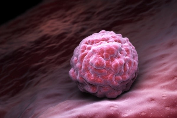 A Comprehensive Guide to Endometrial Receptivity Analysis (ERA)