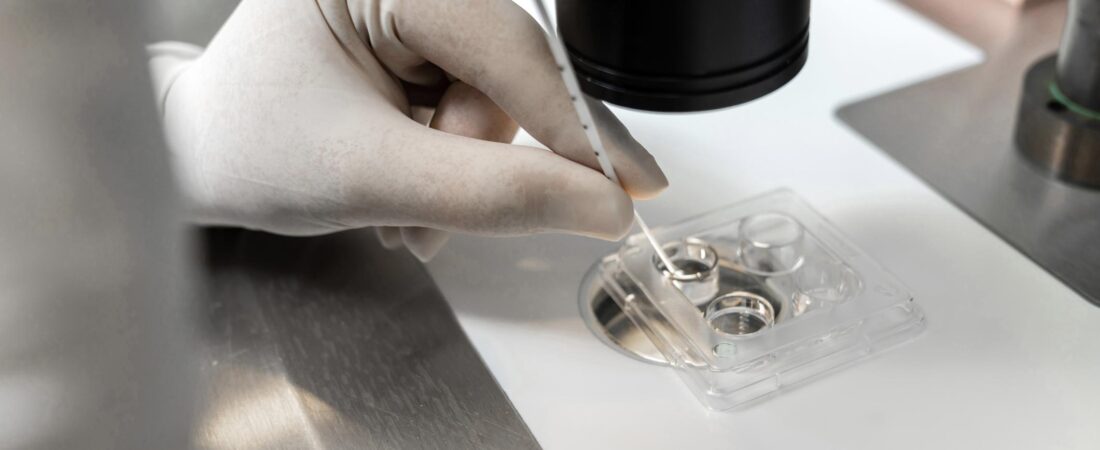 When Fertilization Fails: Investigating the Reasons Behind IVF Disappointments