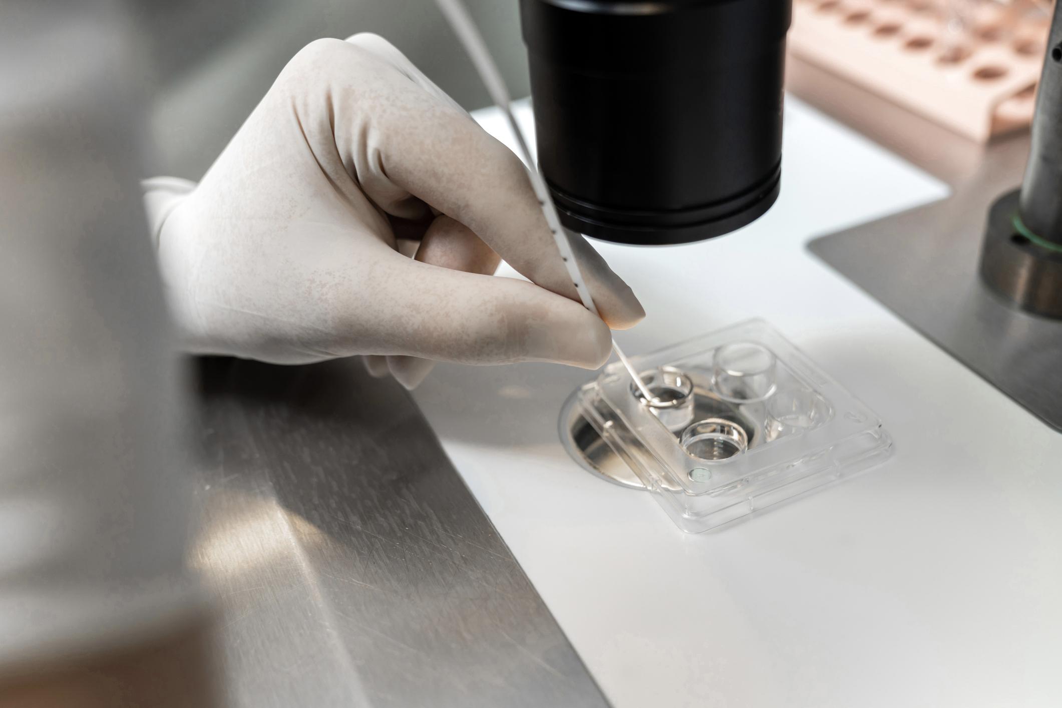 When Fertilization Fails: Investigating the Reasons Behind IVF Disappointments