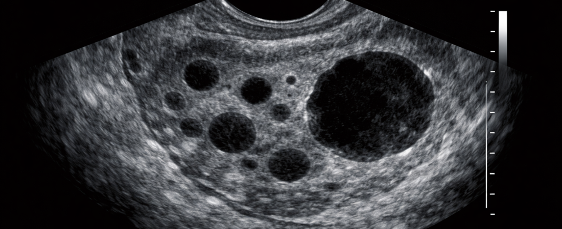 Ultrasound: Beyond Imaging to Clinical Decision-Making