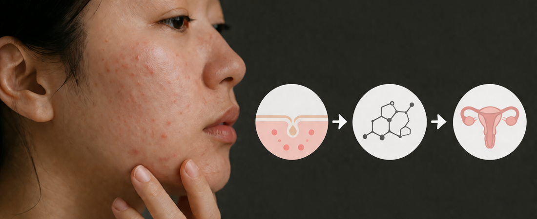 “The Skin as a Mirror of Fertility”: Why Your Complexion May Be Signaling an Hormonal Imbalance