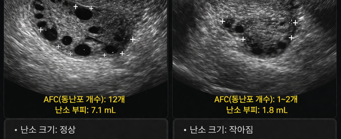 Primary: “Reading Your Ovarian Clock”: Understanding AMH Beyond Just a Number