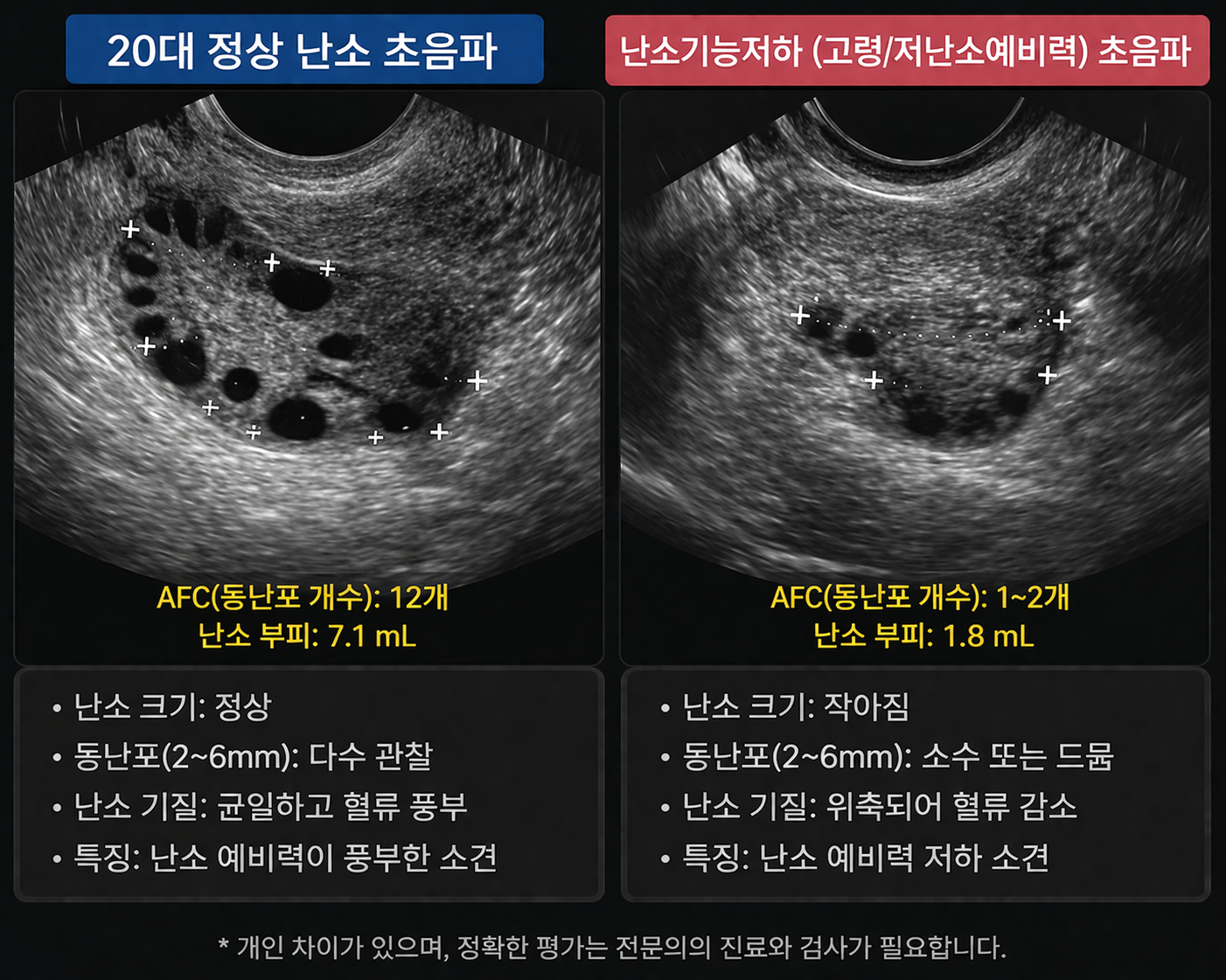 Primary: “Reading Your Ovarian Clock”: Understanding AMH Beyond Just a Number