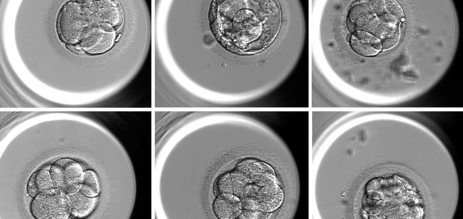 Discarding Potential? The Growing Controversy Over PGT-A in IVF