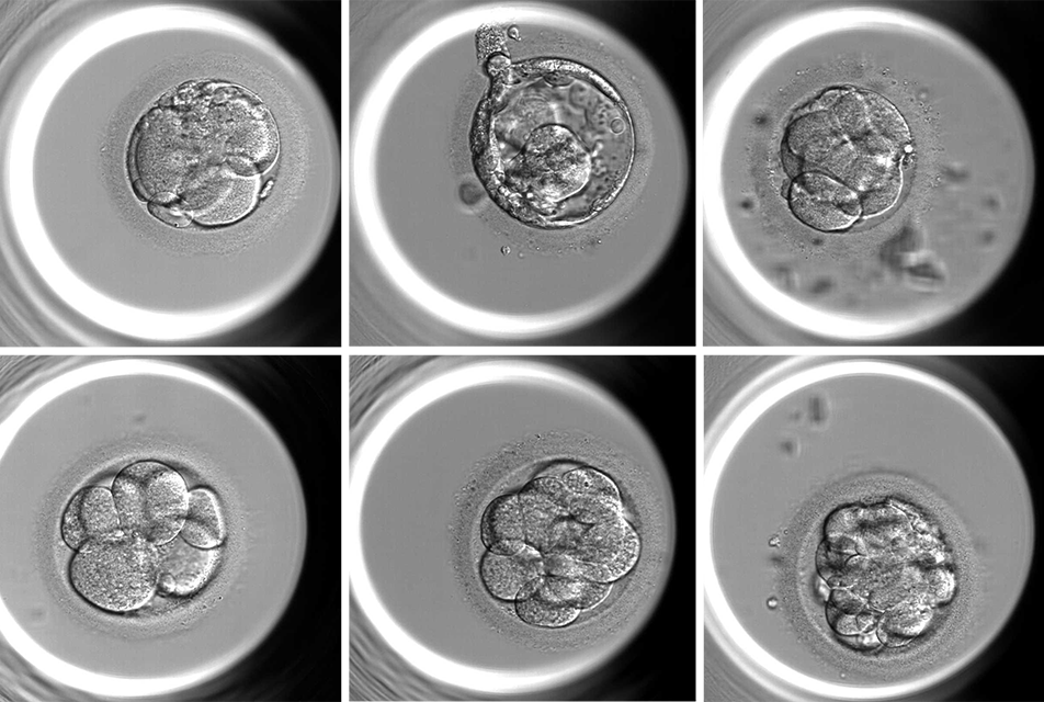 Discarding Potential? The Growing Controversy Over PGT-A in IVF