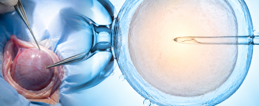 “The Hidden Technique of IVF: Why Testicular Sperm Requires ICSI”