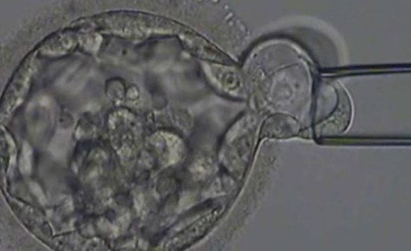 A Comprehensive Guide to Infertility Testing: Essential Steps for Couples