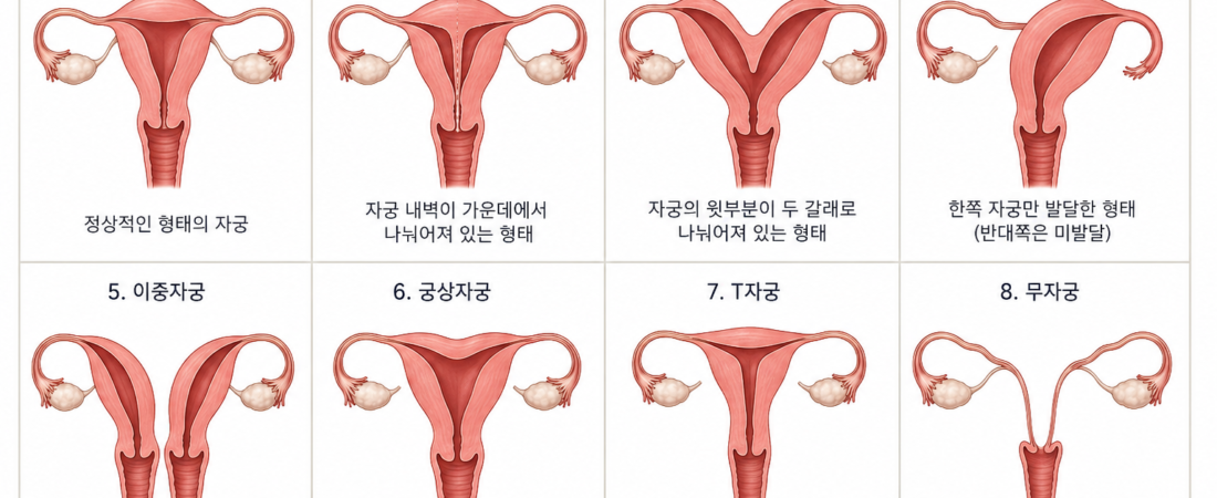 “Uterine Anatomy: Why Diversity Does Not Mean Dysfunction”