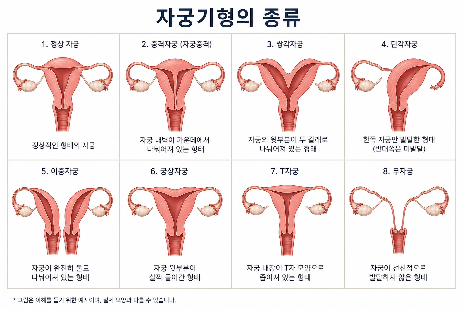 “Uterine Anatomy: Why Diversity Does Not Mean Dysfunction”