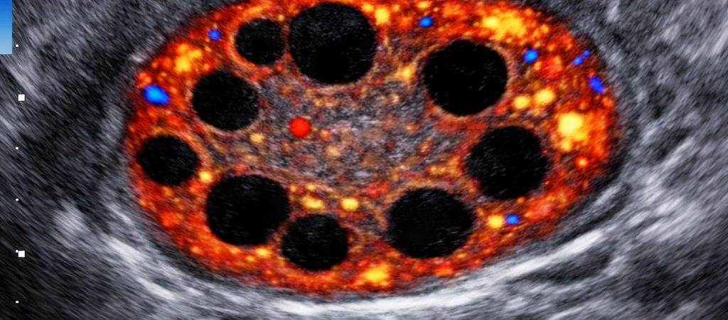 “The Ovary is Not a Warehouse”: The Environmental Crisis Reshaping IVF