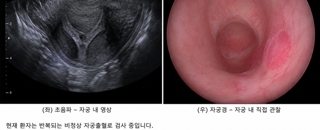 Ultrasound Misses It, But the Camera Finds It