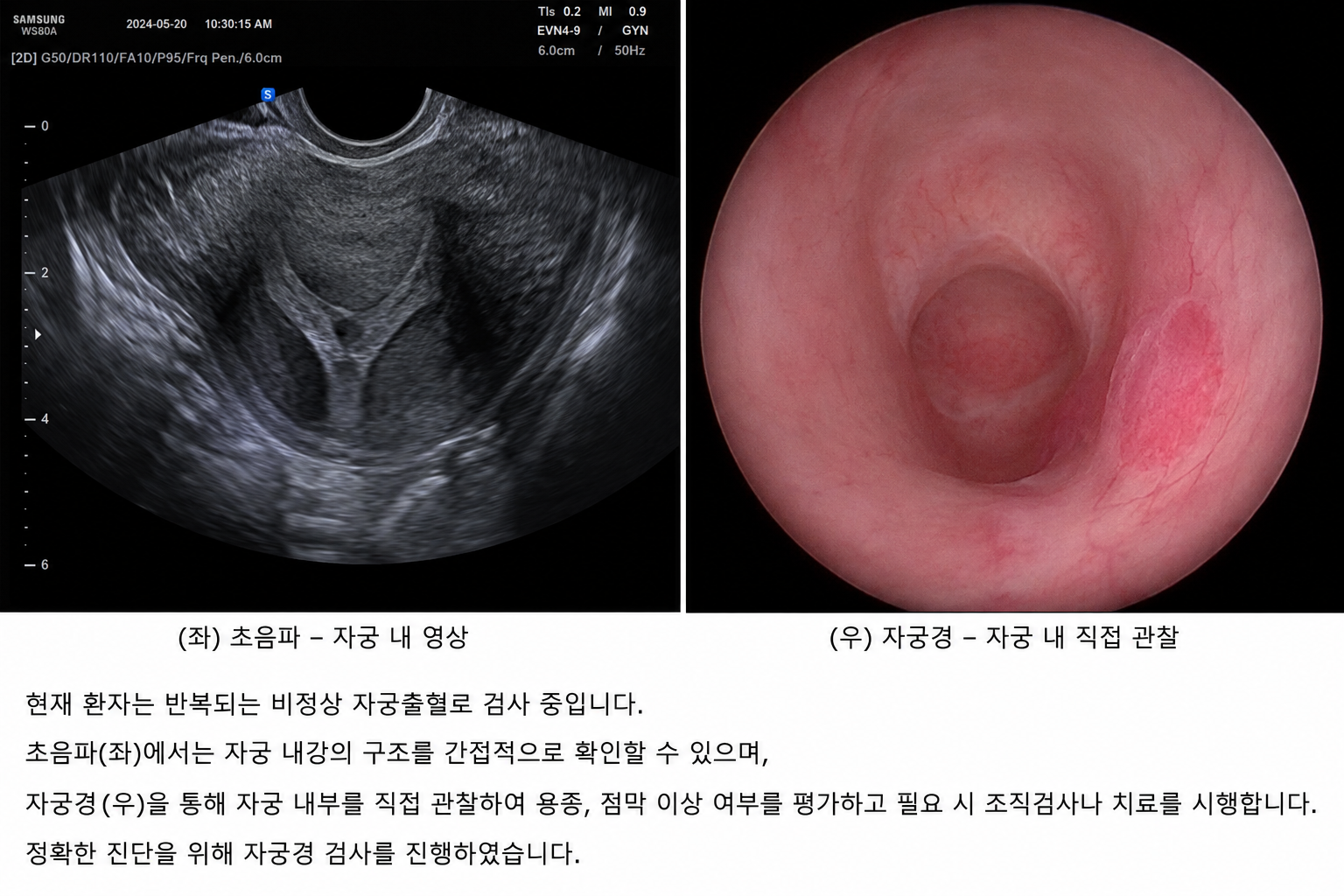 Ultrasound Misses It, But the Camera Finds It