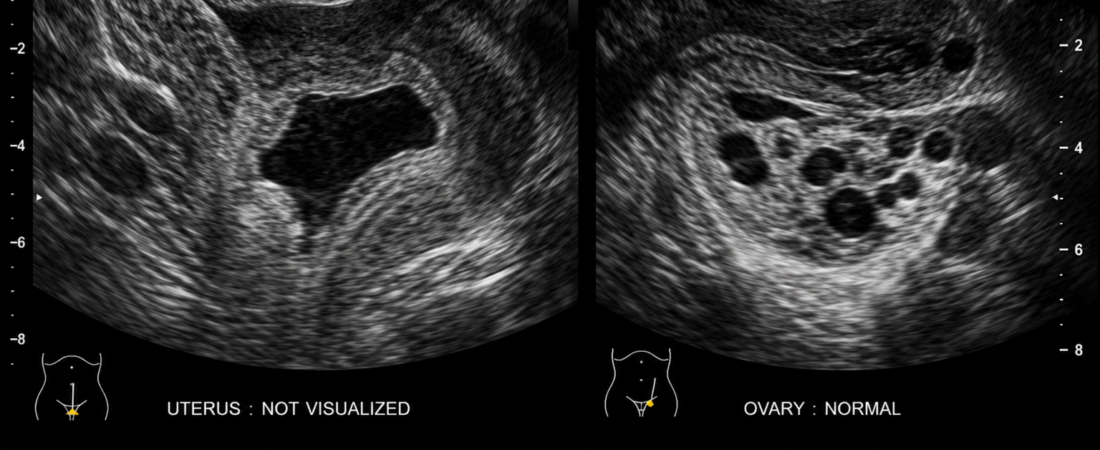 “I Thought It Was Supposed to Hurt”… Born Without a Vagina or with a Very Short One?