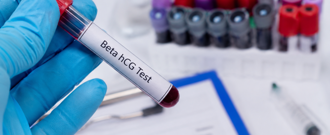 “IVF Pregnancy Success Lies in the Blood Test Numbers”