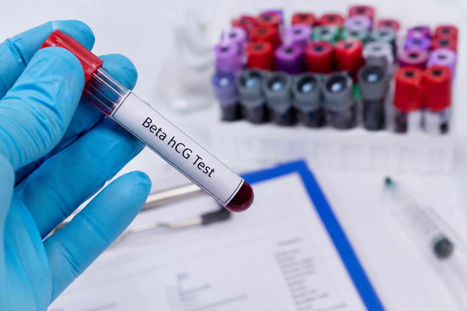 “IVF Pregnancy Success Lies in the Blood Test Numbers”