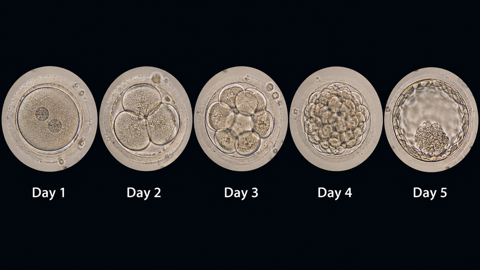 “With Only a Single Embryo, Should We Cultivate It to Day 5?”… A Study Shaking Up Long-Standing IVF Assumptions