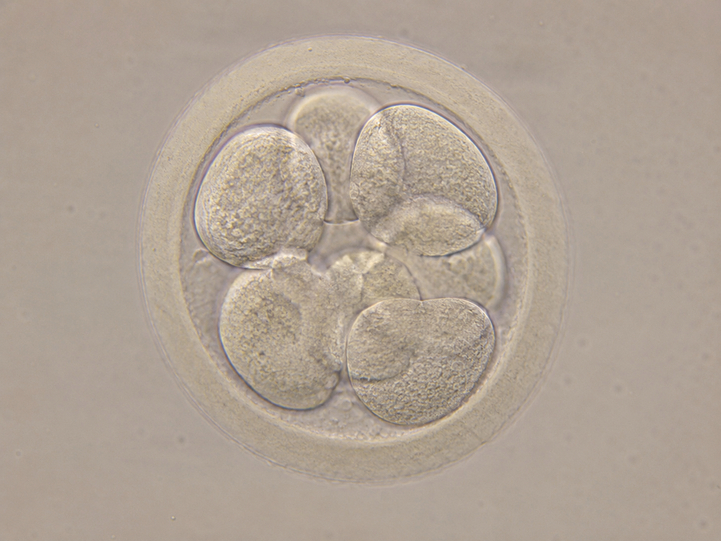 “Reaching Day 7 to Blastocyst? These Embryos Can Still Achieve Pregnancy”