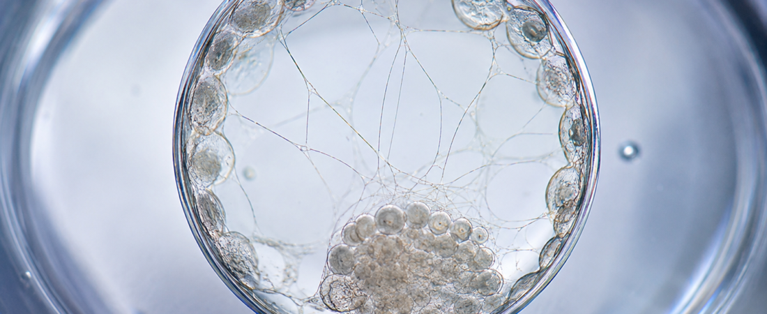 “Do High-Competence Embryos Reveal ‘Strings’?… Delicate Intra-Blastocoelic Bridges Associated with 1.88-Fold Higher Live Birth Odds”