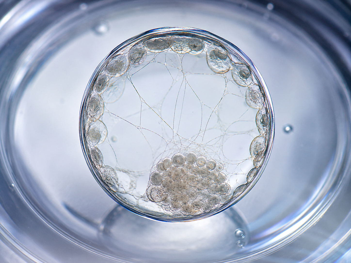 “Do High-Competence Embryos Reveal ‘Strings’?… Delicate Intra-Blastocoelic Bridges Associated with 1.88-Fold Higher Live Birth Odds”