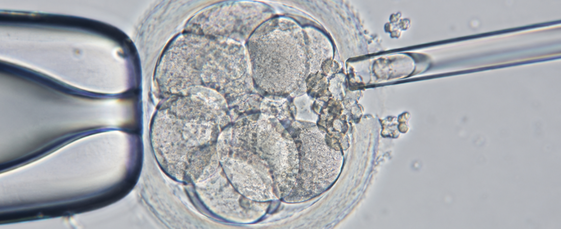 AI-generated illustration of an embryo held by a pipette while a fine instrument approaches cytoplasmic fragments.