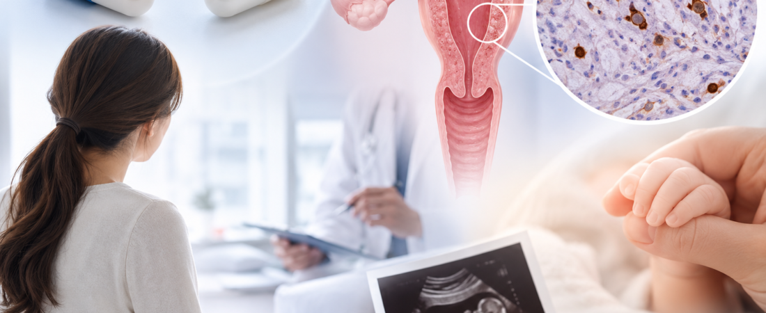 “Should You Take Antibiotics If You’re CD138-Positive?”… Rigorously Tested in Women with Recurrent Miscarriage