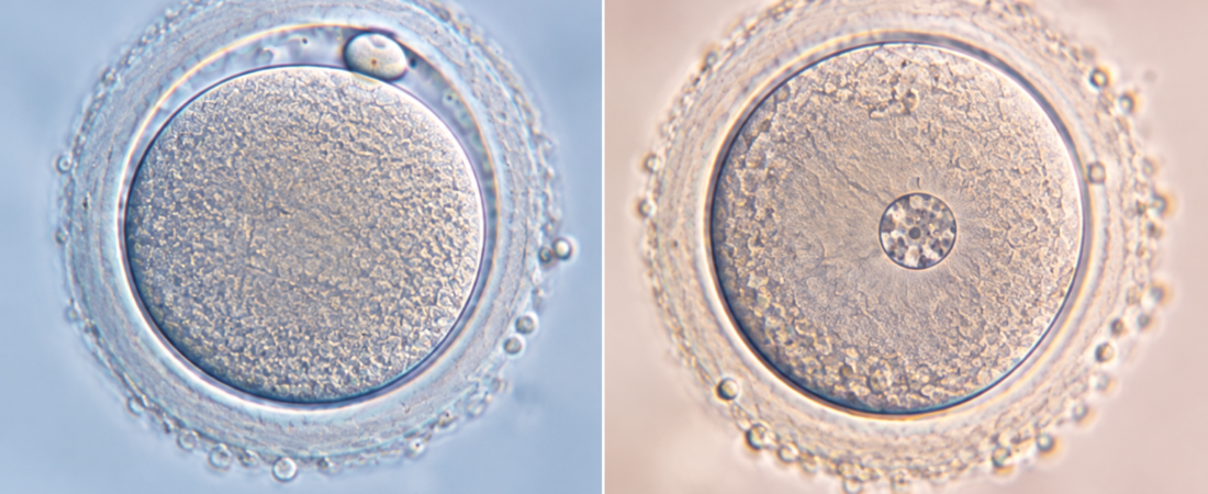 AI illustration comparing a mature oocyte on the left with an immature GV oocyte on the right